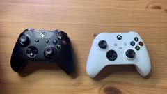 Rakoncátlankodnak az Xbox-kontrollerek gombjai kép