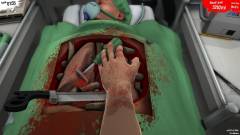 Vajon a valódi sebészeknek jobban megy a Surgeon Simulator? kép