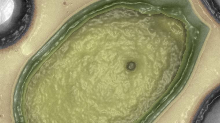 A Marsról érkezhetett a gigantikus óriásvírus kép