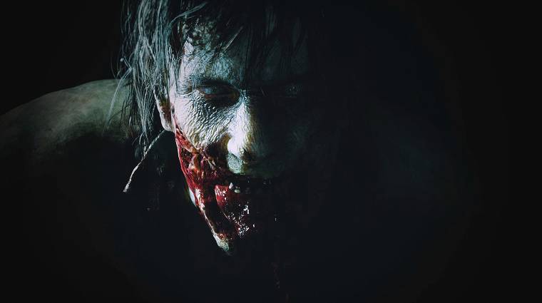 Resident Evil 2 Remake - ennyivel lesz másabb a cenzúrázott változat bevezetőkép