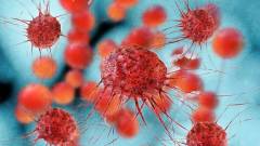 Felfedezték a rák egy új, magas kockázatú altípusát kép
