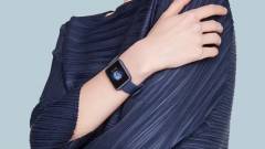 Itt az olcsó Redmi Watch okosóra kép