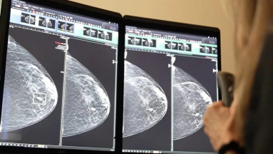 Áttörés a mellrákszűrésben? A DeepHealth új platformja már most átírja a radiológia jövőjét kép