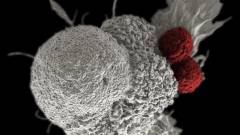 Szegedi kutatók arany nanoszerkezetei segíthetik a daganatok korai felismerését kép