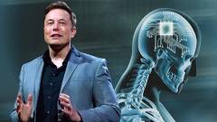 Zöld utat kapott Elon Musk agyba ültethető chipje kép