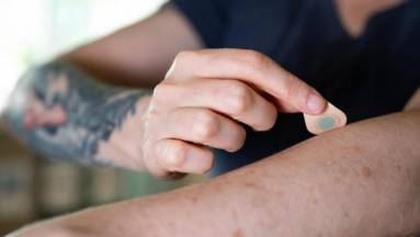 Forradalmi technológia hozta el a fájdalommentes tetoválásokat kép
