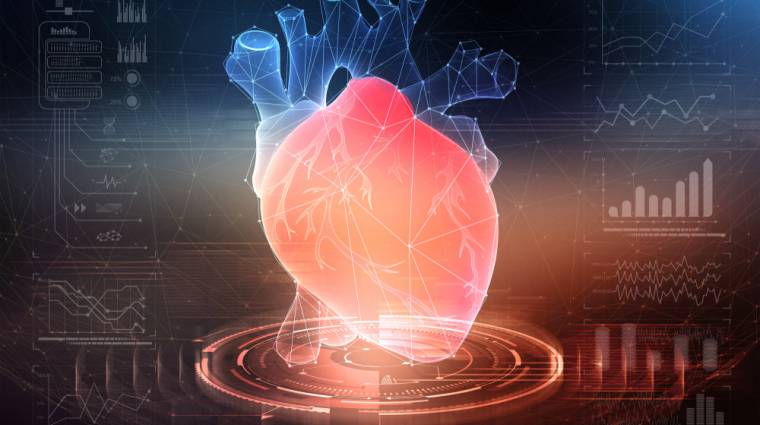 Ez az MI egy röntgenfelvétel alapján 10 évre előre megjósolja a szívrohamokat kép
