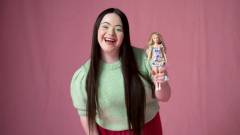 Down-szindrómás Barbie-val újít a Mattel kép