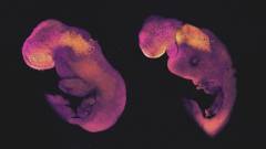 Itt a mesterséges úton létrehozott emberi embrió kép