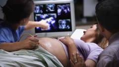 Elkészült a világ első vizeletmentes terhességi tesztje kép