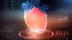 Akár még 10 évre előre is jelezheti a szívrohamot a mesterséges intelligencia kép