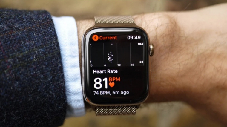 Megint életet mentett egy Apple Watch: érzékelt valamit, amit az orvosok nem kép