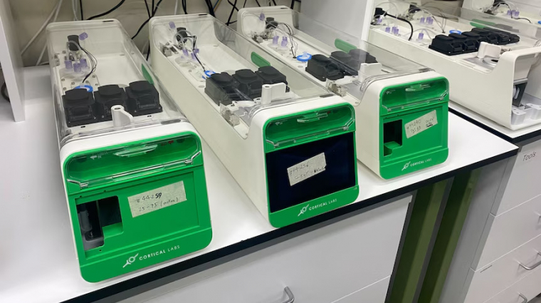 Emberi agysejtek hajtanak hamarosan két új adatközpontot kép