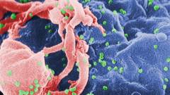Hihetetlen áttörést jelent a komputer tervezte HIV-gyógyszer kép