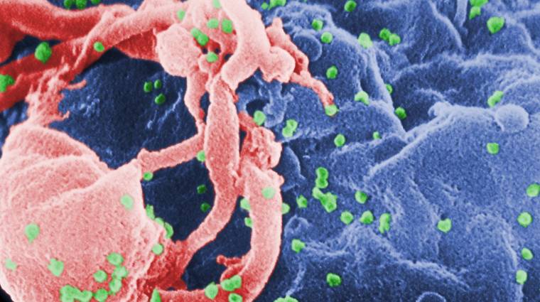 Hihetetlen áttörést jelent a komputer tervezte HIV-gyógyszer kép