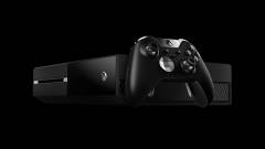 Hardveres frissítéseket kaphat az Xbox One? kép