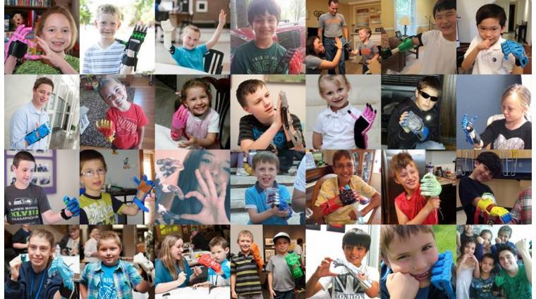 Újabb magyar cég támogatja a végtaghiányos gyermekeket kép